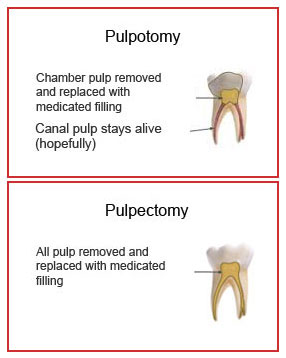 Pulp Therapy