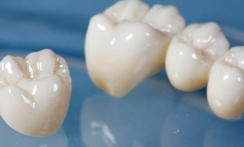 All-ceramic or all-porcelain dental crowns