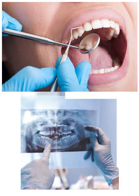 Dental Consulation/Examination