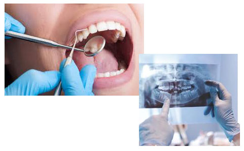 Dental Consulation/Examination